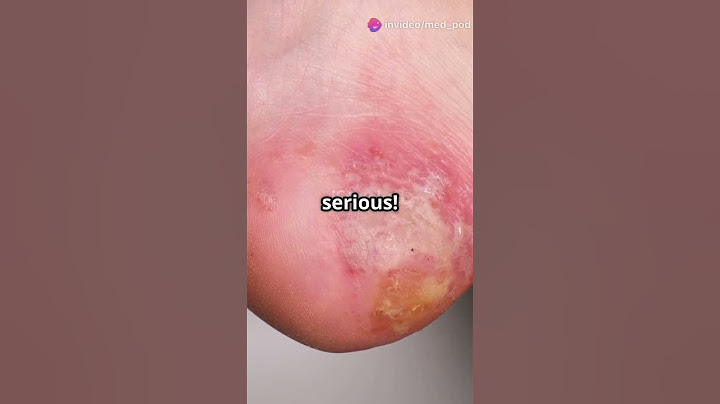 Your Skin Is Peeling? Here’s What It Means & When to Worry! 😨🩸#shorts #facts  #asmr #music #mrbeast