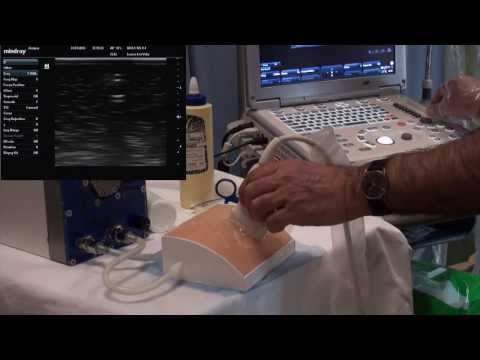 Axiom Pulsatile Flow Simulator: Teaching venous reflux time assesment