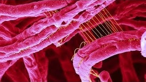 The Best Documentary Ever - What is Anthrax Disease? ()