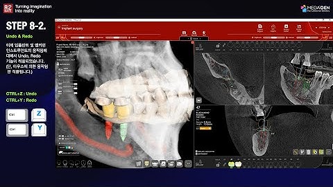 [한글] R2GATE Stand Alone update: Step.8-2 Un-DO 와 Re-DO 기능 추가
