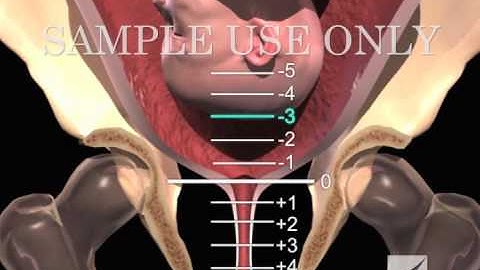 Birth Stations of Presentation (-5 to +5 Positions)