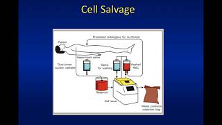 Obsgynaecritcare 6  Strategies to decrease blood loss part 2