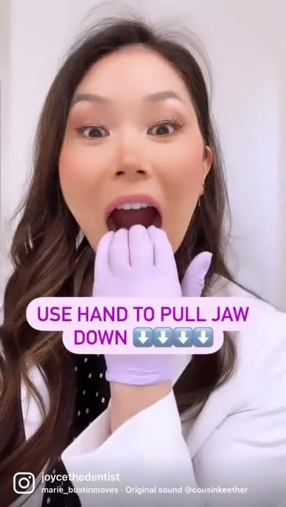 3 simple Jaw Exercises after an Accident #shorts #dentist
