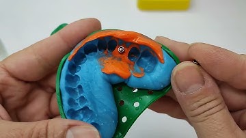 IMPLANTE DENTAL PREPARACIÓN PARTE 1.#nuriadental #protesisdental #esteticadental #implantesdentarios