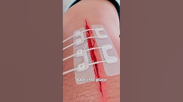 How ZipStitch Works 😮