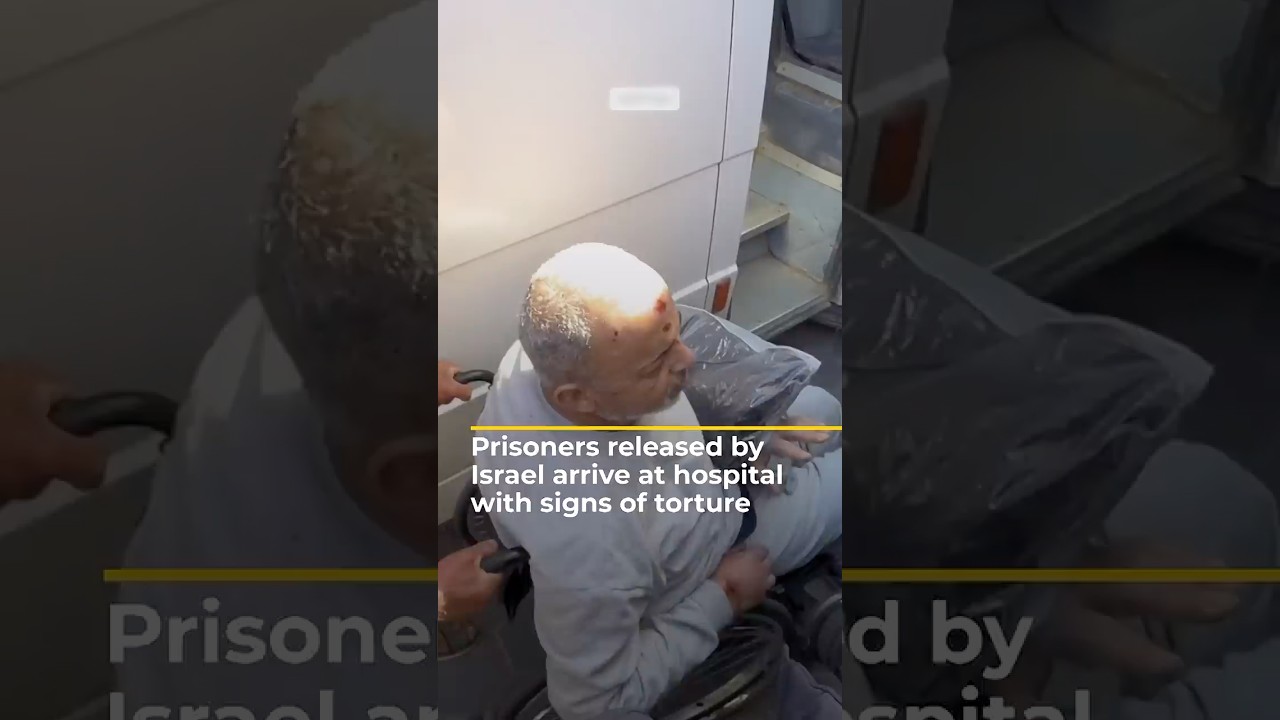 وصل سجناء أطلقت إسرائيل سراحهم إلى المستشفى وعليهم آثار تعذيب.