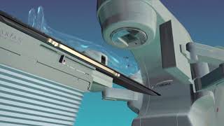 TrueBeam IMRT 720p