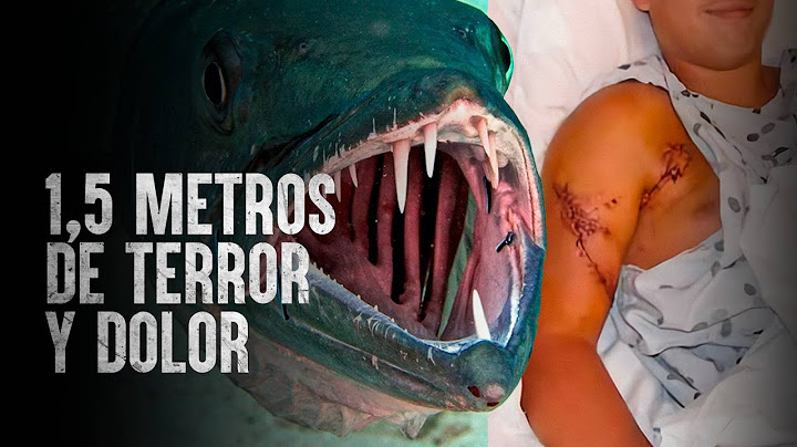 Cómo Sobrevivir un ataque de barracudas