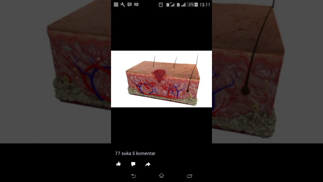 Wound healing 3c Wound healing 3c