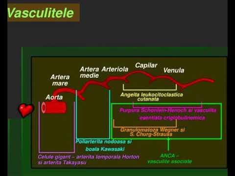 Video: Vasculita Necrotizantă: Cauze, Simptome și Diagnostic