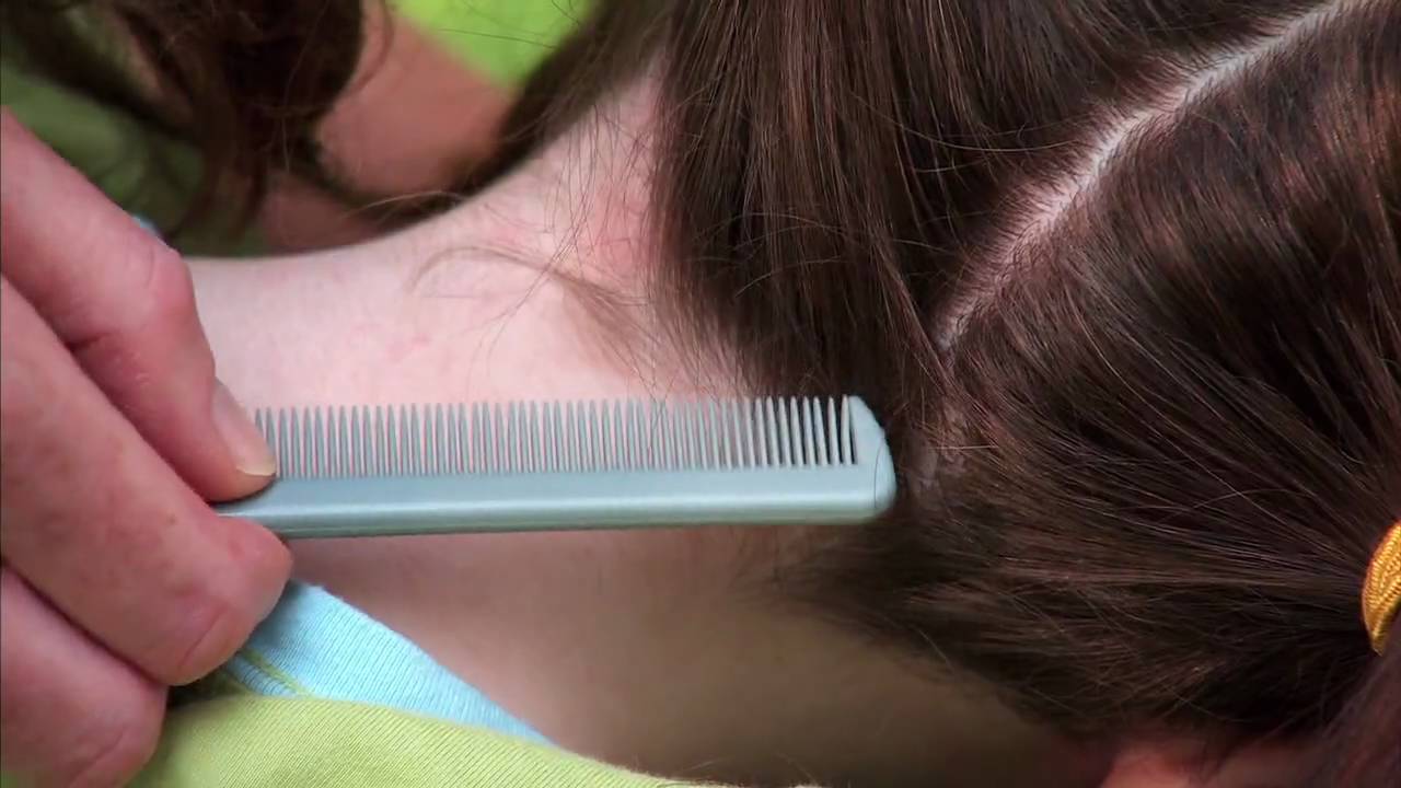 How to check your child for head lice - YouTube