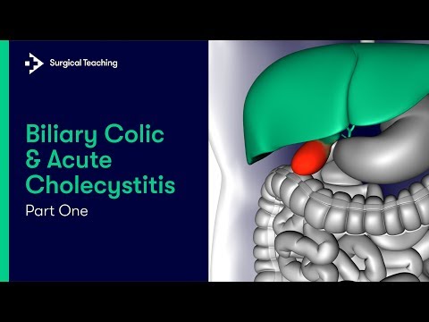Biliary Colic & Acute Cholecystitis Part 1 | Learn the Important Anatomy of the Biliary System
