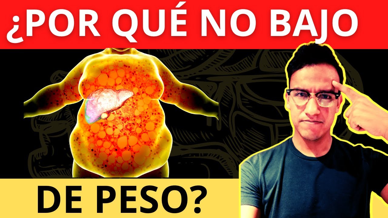 10 RAZONES por las que no PUEDES BAJAR DE PESO - YouTube