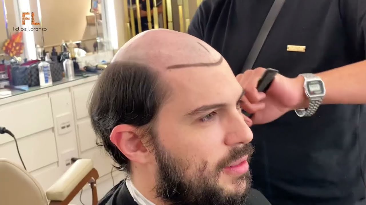 Prótese Capilar Masculina no Salão Felipe Lorenzo: Transformação Incrível!