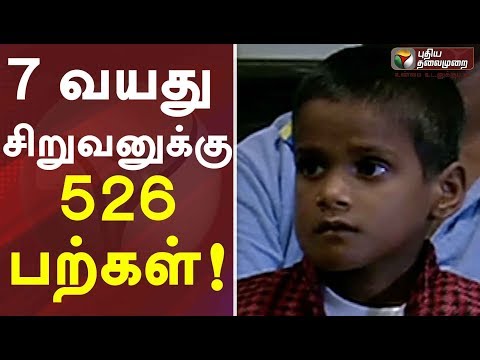 7 வயது சிறுவனுக்கு 526 பற்கள்! அறுவை சிகிச்சை மூலம் அகற்றம்