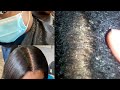 Dry Flaky Scalp Treatment For Relaxed Hair