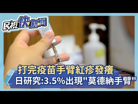打完疫苗手臂紅疹發癢 日本研究:3.5%人出現"莫德納手臂"－民視新聞