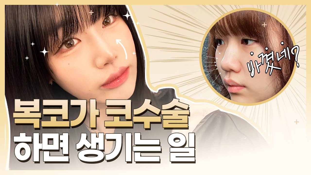 [Риэнжанг гоо сайхны мэс заслын эмнэлэг] Хамарны мэс засал хийлгэсэн ч намайг турсан гэж хүмүүс ярьдаг.