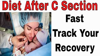 Diet Plan After C Section: How To Fast Track Your Recovery 2022