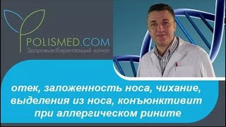 Симптомы аллергического ринита: отек, заложенность носа, чихание, выделения из носа, конъюнктивит