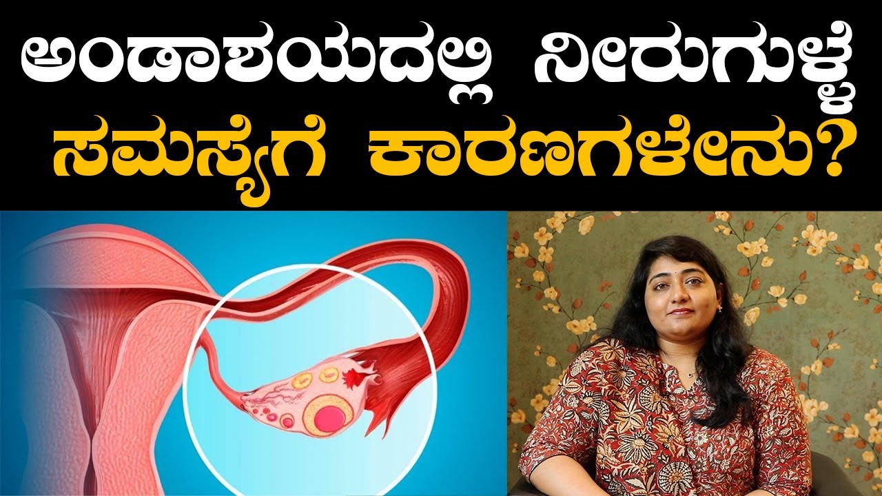 Ovarian cysts - Symptoms and causes | ಅಂಡಾಶಯದಲ್ಲಿ ನೀರುಗುಳ್ಳೆ ಇದ್ರೆ ಮಕ್ಕಳಾಗೋದಿಲ್ವಾ? | Vijay Karnataka