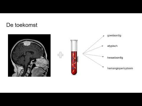 StichtingSTOPhersentumoren nl project UMCU EduardVoormolen