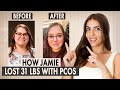 How jamie lost 31 pounds with pcos  learn her method