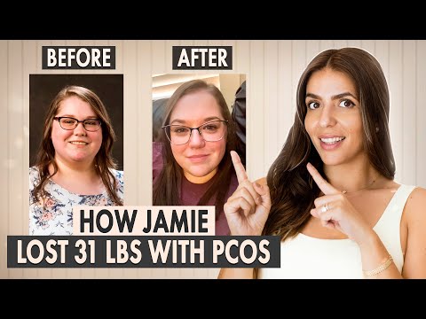 How Jamie Lost 31 Pounds with PCOS | Learn Her Method!