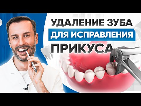 Удаления зуба для исправления прикуса. Реальный пример в клинике OrthoLike