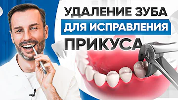 Удаления зуба для исправления прикуса. Реальный пример в клинике OrthoLike