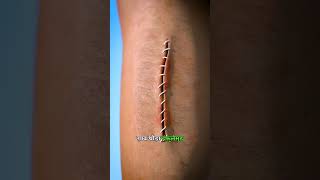 The hidden science of stitches Doctor Don't explain.🧵#health #scienceexperiment