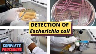 Detection of Escherichia coli (E. coli)_A Complete Procedure (ISO 9308-1 & ISO 16649)