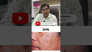 Common Skin Problems: Skin Tags & DPN | Dr. Sunil Kothiwala | #SkinTags #DPN