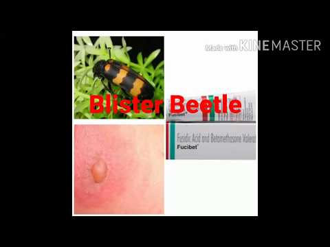 Vidéo: Blister Beetle Bite: À Propos, Photos, Traitement Et Prévention