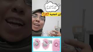 شق العجان أثناء الولادة الطبيعية مش لكل الناس و ازاى تقدرى تمنعيه ⁉️??