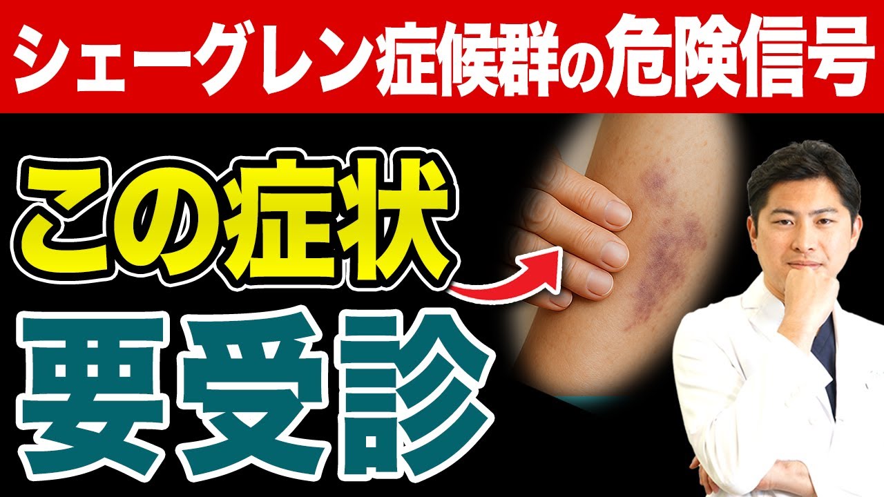 【医師が解説】シェーグレン症候群が進行するとどうなる？3つの症状と具体的な対策【シェーグレン症候群/目の乾き/口の渇き】