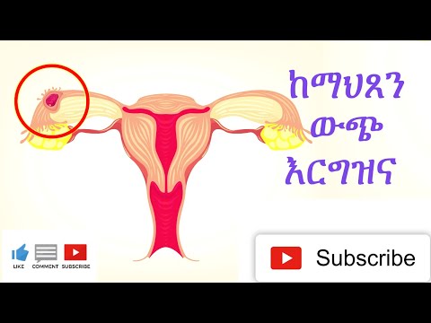 ቪዲዮ: ለፍቺ እንዴት መዘጋጀት እንደሚቻል