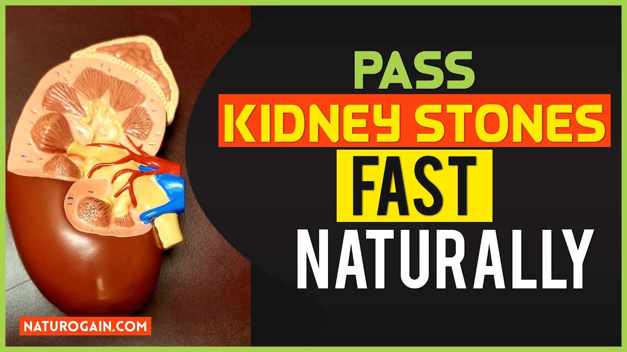 Best Natural Ways to Pass Kidney Stones, Herbal Treatment for Kidney