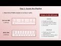Intro to EKG Interpretation - A Systematic Approach