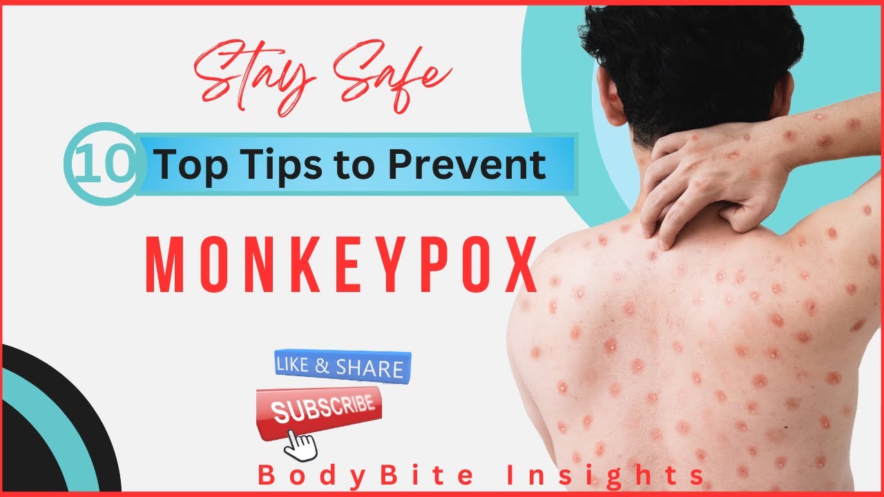 STAY SAFE: TOP TIPS TO PREVENT MONKEYPOX!