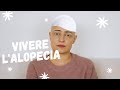 Vivere l'Alopecia Areata - La mia storia