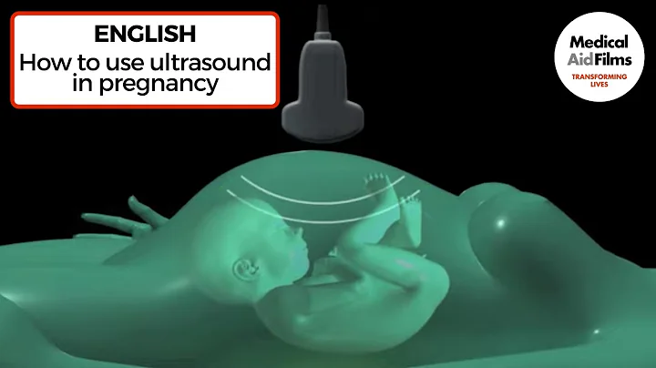 How to use ultrasound in pregnancy - DayDayNews