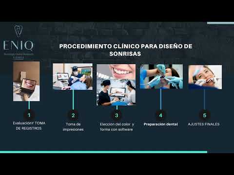 Diseño de sonrisa - ENIQ
