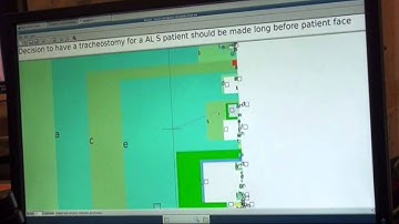 Paralyzed person uses a brain-computer interface to type