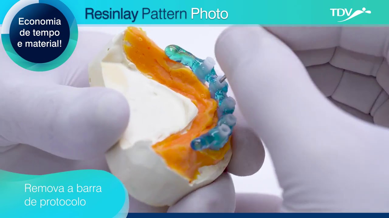 RESINLAY PATTERN TDV Dental YouTube