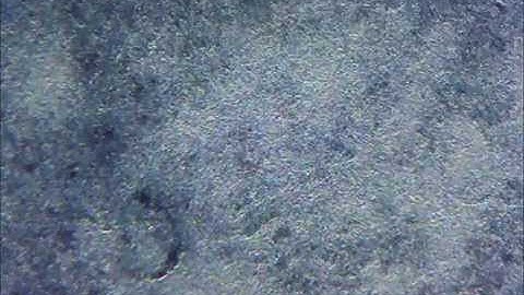 Contracting cardiomyocytes using PSC Cardiomyocyte Differentiation Kit