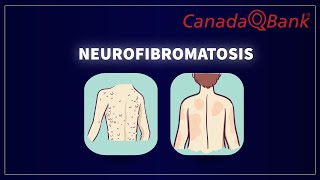 Neurofibromatosis by CanadaQBank 2,092 views 3 months ago 6 minutes, 43 seconds