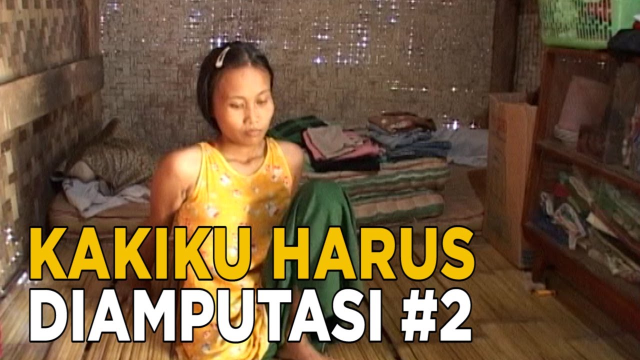 Kakiku harus diamputasi karena tumor | KEJAMNYA DUNIA