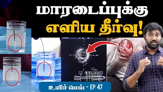 மாரடைப்புக்கு காரணம் இதுதான் | எளிய தீர்வை முன்வைக்கும் மருத்துவர் | Laser angioplasty|UYIRMEI EP47