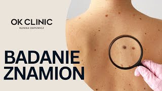 Badanie znamion - przygotowanie i zasada ABCDE